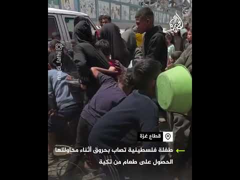 طفلة تصاب بحروق أثناء محاولتها الحصول على طعام من تكية في غزة