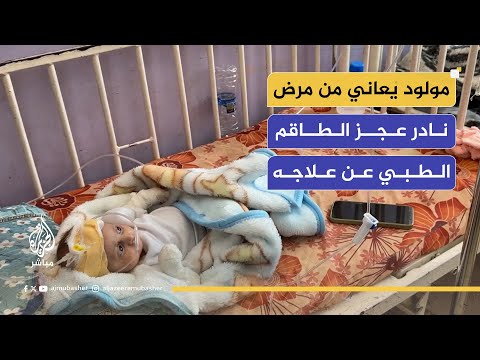 طفل يعاني منذ لحظة ولادته من مرض نادر عجز الطاقم الطبي عن علاجه