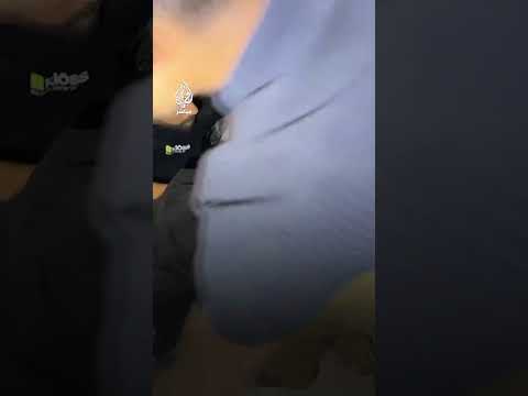 نحو 50 شهيدا وأكثر من 100 جريح وعدد من المفقودين جراء غارات إسرائيلية متزامنة على شمال غزة