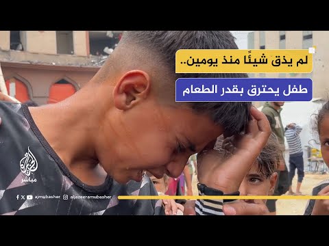 لم يذق شيئًا منذ يومين. طفل أُصيب بحروق أثناء إحضاره الطعام من القدر.