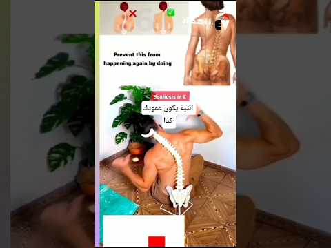 حركة واحدة لتصحيح ميلان الحوض والعمود الجانبي  تحسين الثبات استقامة الجسم في دقائق