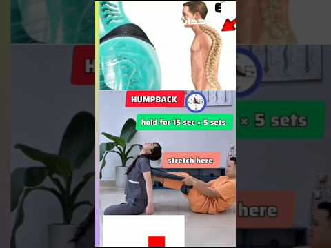 تمارين لتقليل حدبة الظهر دعم استقامة أعلى الظهر تخفيف الضغط تحسين القوام وتقليل الألم#تمارين_علاجية