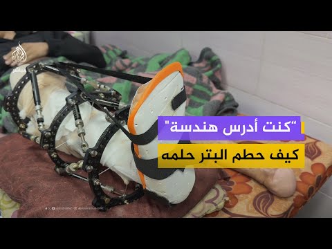"بدي ثلاث عمليات معقدة".. جريح بقدمه يستغيث بعد شهرين من التنقل بين المستشفيات دون علاج