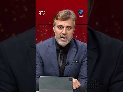 هل فضح كأس العالم أمريكا؟