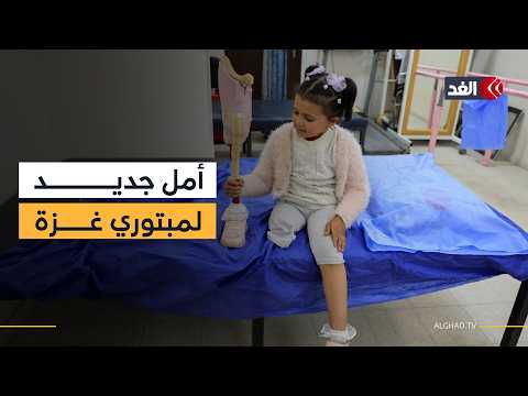 المستشفى الإماراتي العائم يواصل تنفيذ برنامج «خطوة أمل» لمبتوري الأطراف بغزة ضمن «الفارس الشهم 3»