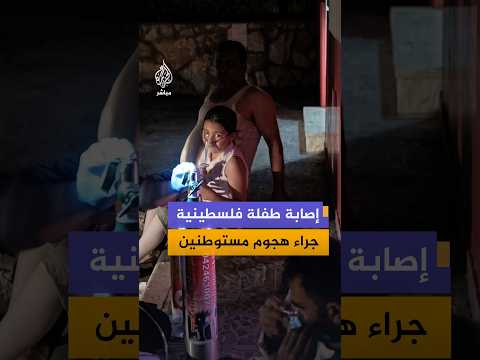 إصابة 3 فلسطينيين بينهم طفلة جراء هجوم مستوطنين على مركبتهم مستخدمين غاز الفلفل بالقرب من مدينة جنين