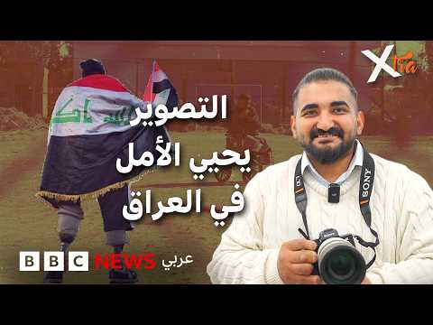 كيف غيّرت الكاميرا حياة شاب عراقي بعد فقدان ساقه؟