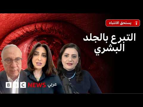 كيف تساعد زراعة الجلد والأنسجة البشرية في إنقاذ مرضى الحروق؟