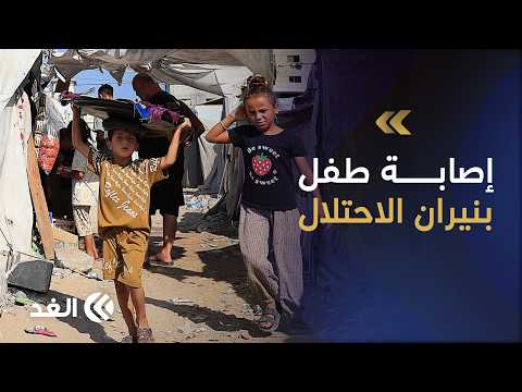 إصابة طفل بنيران الاحتلال شمال غربي مدينة غزة وسط تصاعد الخروقات الإسرائيلية في القطاع
